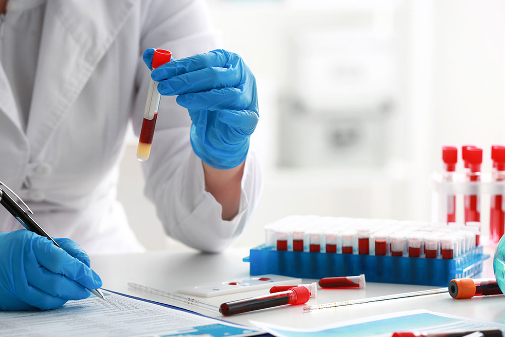 Gloved hands of a laboratory technician holding a test tube containing a blood sample, with multiple labeled blood vials and lab equipment arranged on a workbench in a clinical laboratory.